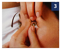 contact-lens-removal-image-8
